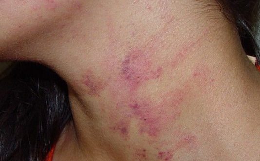 No Bairro Itaipu em Mundo Novo, mulher tem casa invadida por ex-marido, é agredida com estrangulamento e empurrões