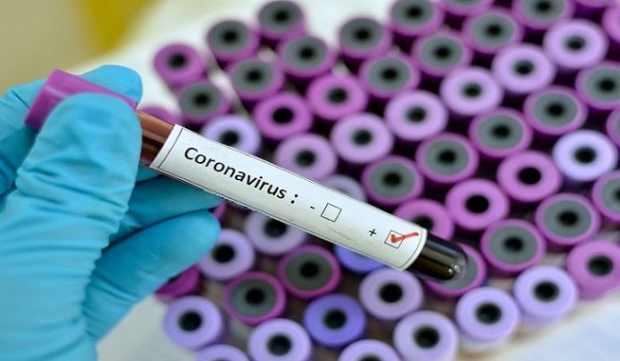 coronavirus-teste-730x425