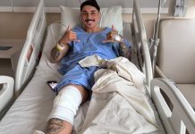 Juventude AG prepara retorno de lesionados para reta final da temporada